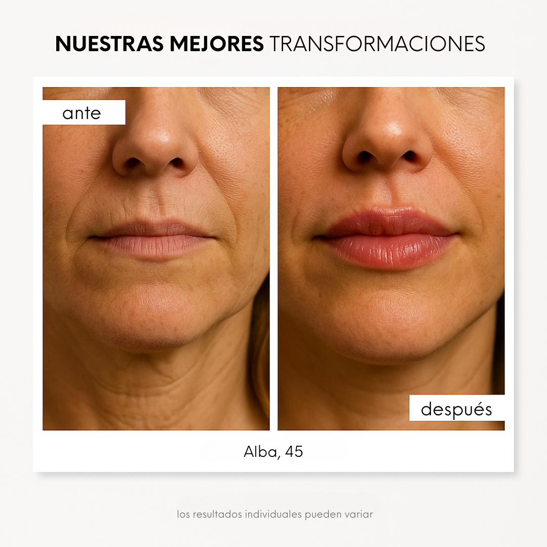 Lip Boost Dediras