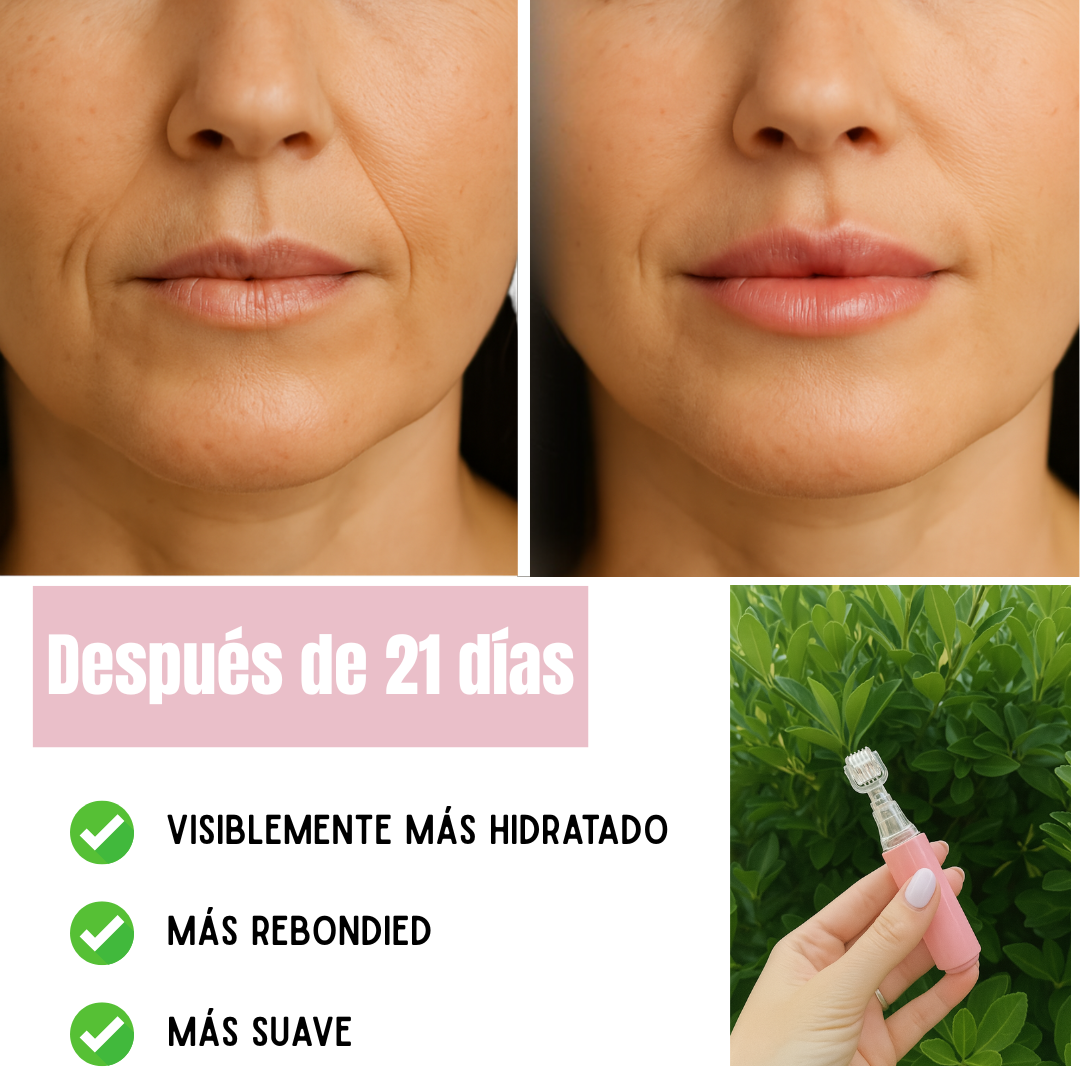 Lip Boost Dediras