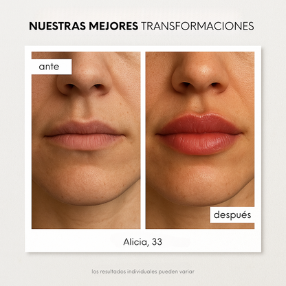 Lip Boost Dediras