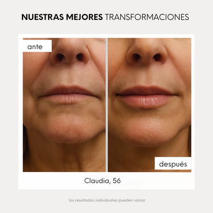 Lip Boost Dediras